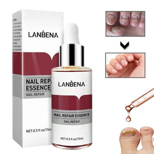 ✨SERUM LANBENA ANTI HONGOS✨