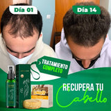 OUHOE - ELÍXIR PARA TU CABELLO